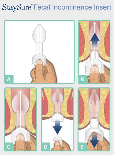 insert diagram